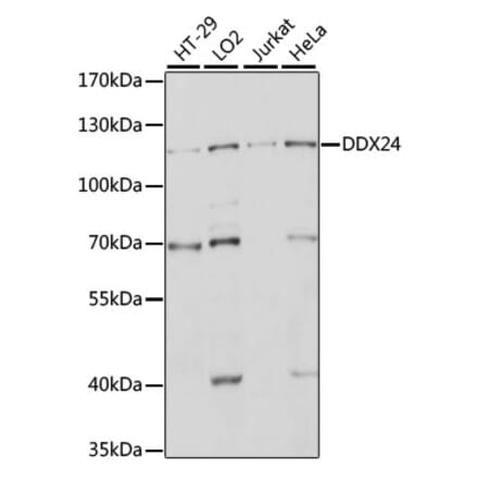 Western Blot - Anti-DDX24 Antibody (A88044) - Antibodies.com