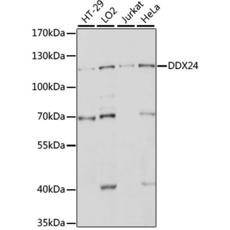 Western Blot - Anti-DDX24 Antibody (A88044) - Antibodies.com