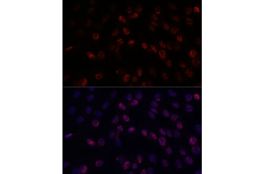 Immunofluorescence - Anti-DDX24 Antibody (A88044) - Antibodies.com