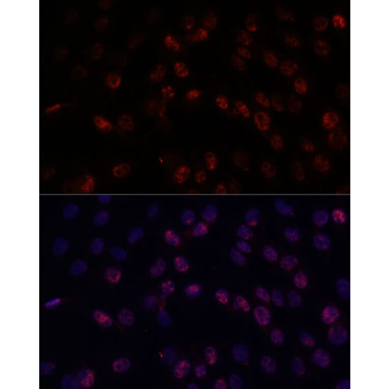 Immunofluorescence - Anti-DDX24 Antibody (A88044) - Antibodies.com