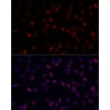 Immunofluorescence - Anti-DDX24 Antibody (A88044) - Antibodies.com