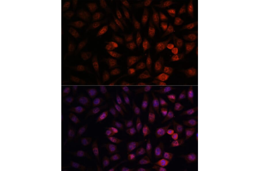 Immunofluorescence - Anti-DDX24 Antibody (A88044) - Antibodies.com