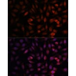 Immunofluorescence - Anti-DDX24 Antibody (A88044) - Antibodies.com