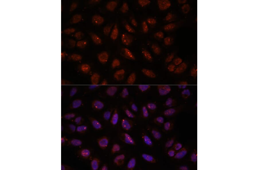 Immunofluorescence - Anti-DDX24 Antibody (A88044) - Antibodies.com
