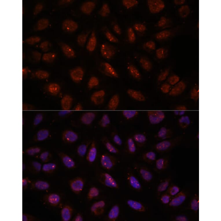 Immunofluorescence - Anti-DDX24 Antibody (A88044) - Antibodies.com