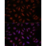 Immunofluorescence - Anti-DDX24 Antibody (A88044) - Antibodies.com