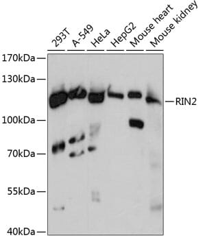 Western blot analysis of extracts of various cell lines, using Anti-RIN2 Antibody (A13798) at 1:3000 dilution.
Secondary antibody: Goat Anti-Rabbit IgG (H+L) (HRP) (AS014) at 1:10,000 dilution.
Lysates / proteins: 25µg per lane.
Blocking buffer: 3% non-fat dry milk in TBST.
Detection: ECL Basic Kit (RM00020).
Exposure time: 90s.
