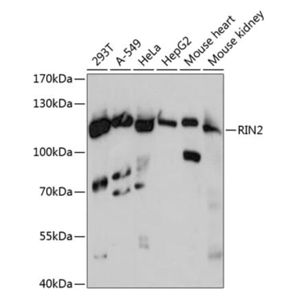 Western Blot - Anti-RIN2 Antibody (A88045) - Antibodies.com