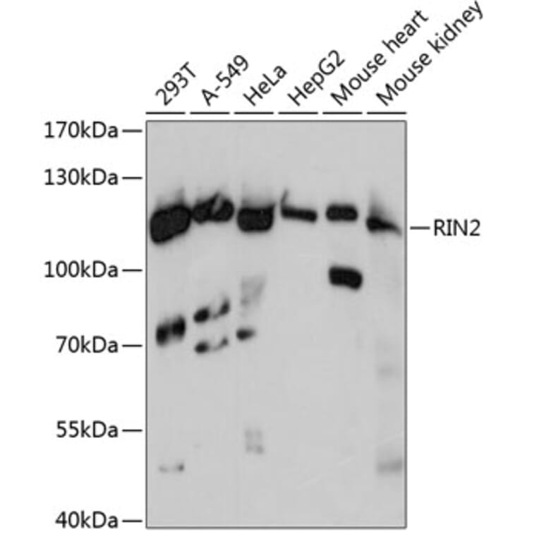 Western Blot - Anti-RIN2 Antibody (A88045) - Antibodies.com