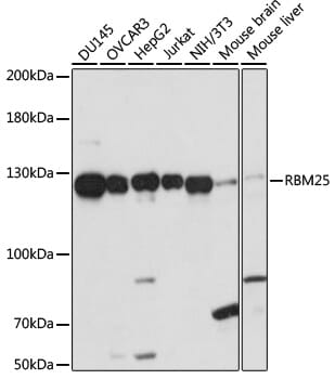 Western blot analysis of extracts of various cell lines, using Anti-RBM25 Antibody (A15496) at 1:1,000 dilution.
Secondary antibody: Goat Anti-Rabbit IgG (H+L) (HRP) (AS014) at 1:10,000 dilution.
Lysates / proteins: 25µg per lane.
Blocking buffer: 3% non-fat dry milk in TBST.
Detection: ECL Basic Kit (RM00020).
Exposure time: 60s.