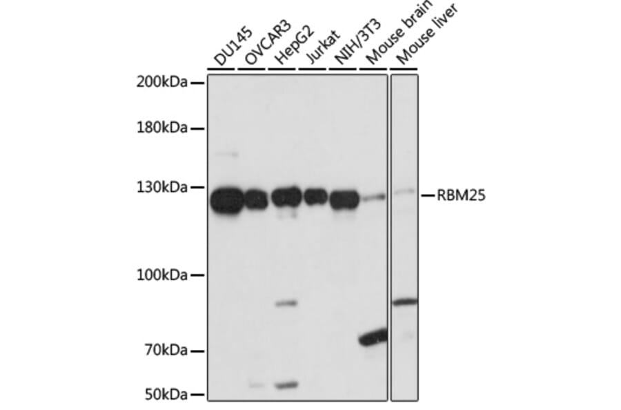 Western Blot - Anti-RBM25 Antibody (A88046) - Antibodies.com