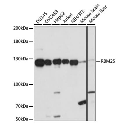 Western Blot - Anti-RBM25 Antibody (A88046) - Antibodies.com