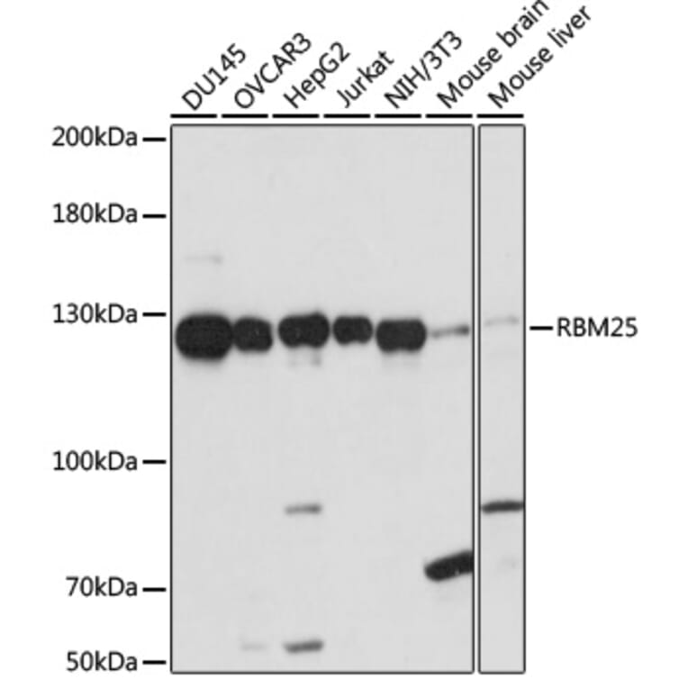 Western Blot - Anti-RBM25 Antibody (A88046) - Antibodies.com
