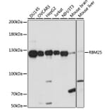 Western Blot - Anti-RBM25 Antibody (A88046) - Antibodies.com