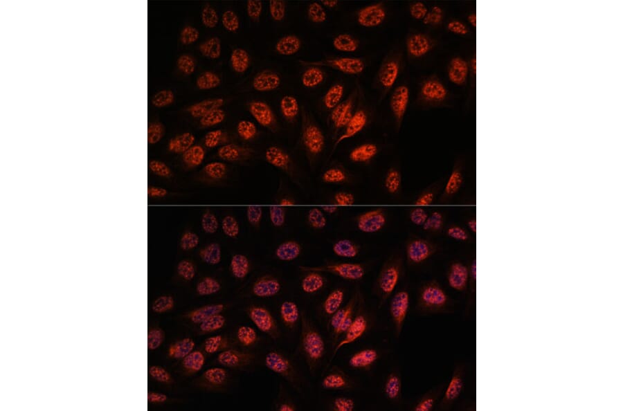 Immunofluorescence - Anti-RBM25 Antibody (A88046) - Antibodies.com