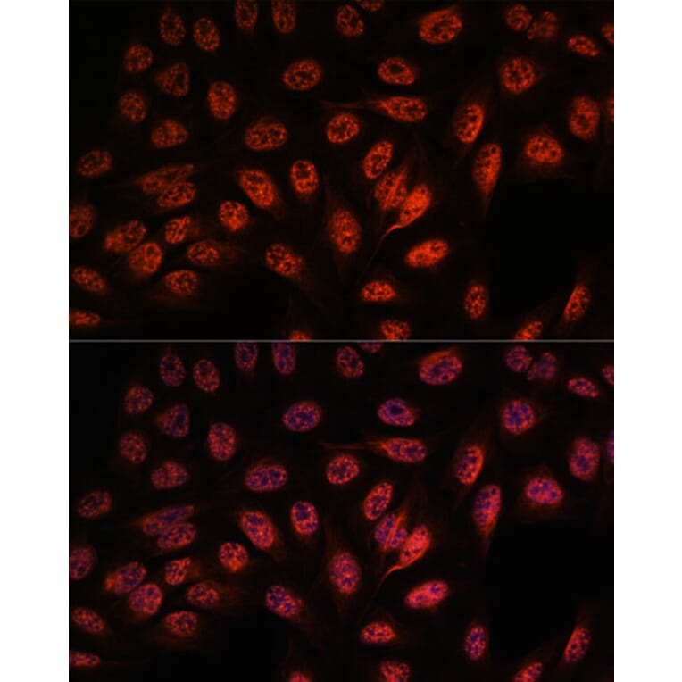 Immunofluorescence - Anti-RBM25 Antibody (A88046) - Antibodies.com
