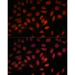 Immunofluorescence - Anti-RBM25 Antibody (A88046) - Antibodies.com