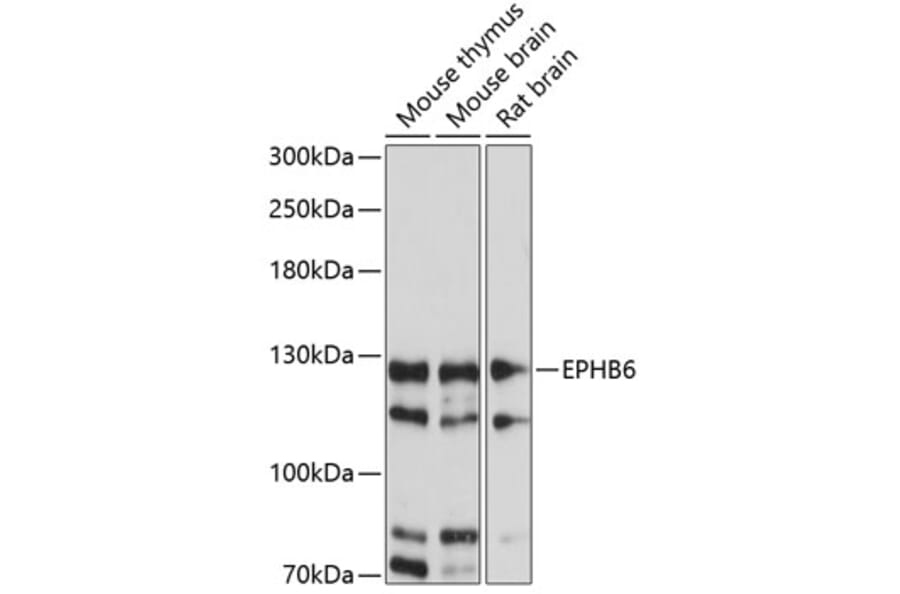 Western Blot - Anti-Eph receptor B6 Antibody (A88047) - Antibodies.com