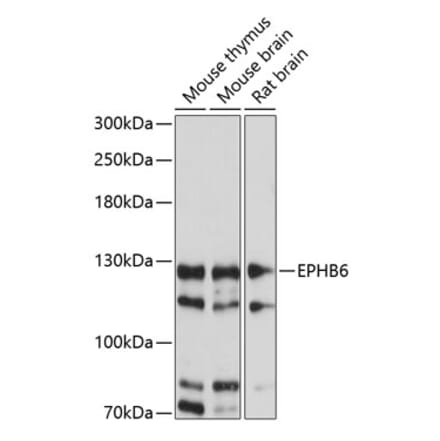 Western Blot - Anti-Eph receptor B6 Antibody (A88047) - Antibodies.com