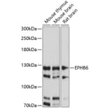 Western Blot - Anti-Eph receptor B6 Antibody (A88047) - Antibodies.com