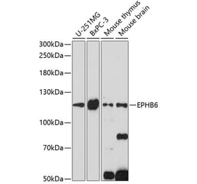 Western Blot - Anti-Eph receptor B6 Antibody (A88048) - Antibodies.com
