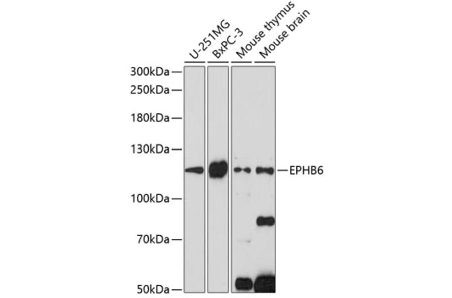 Western Blot - Anti-Eph receptor B6 Antibody (A88048) - Antibodies.com