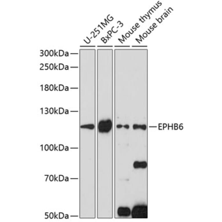 Western Blot - Anti-Eph receptor B6 Antibody (A88048) - Antibodies.com