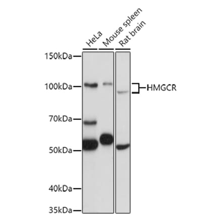 Western Blot - Anti-HMGCR Antibody (A88049) - Antibodies.com