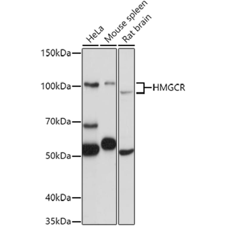 Western Blot - Anti-HMGCR Antibody (A88049) - Antibodies.com