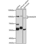 Western Blot - Anti-HMGCR Antibody (A88049) - Antibodies.com