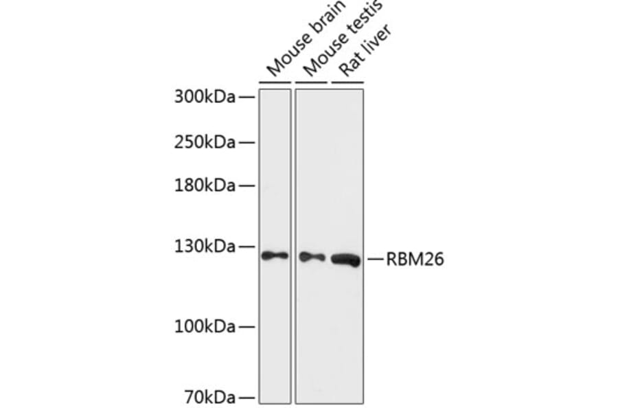 Western Blot - Anti-RBM26 Antibody (A88050) - Antibodies.com