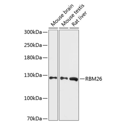 Western Blot - Anti-RBM26 Antibody (A88050) - Antibodies.com