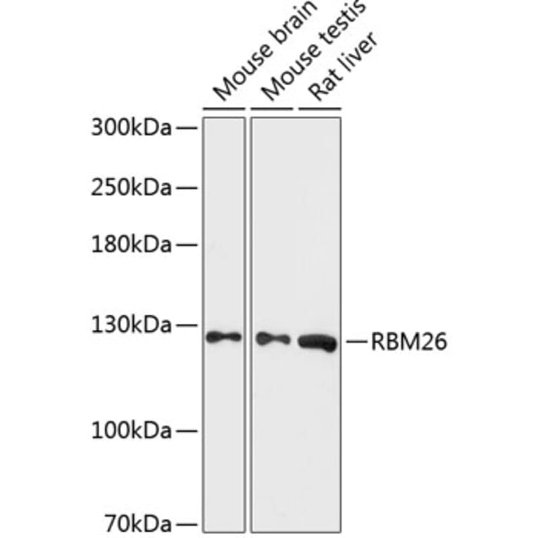 Western Blot - Anti-RBM26 Antibody (A88050) - Antibodies.com