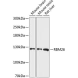 Western Blot - Anti-RBM26 Antibody (A88050) - Antibodies.com