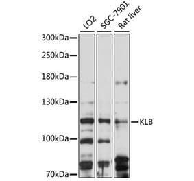 Western Blot - Anti-KLB Antibody (A88051) - Antibodies.com