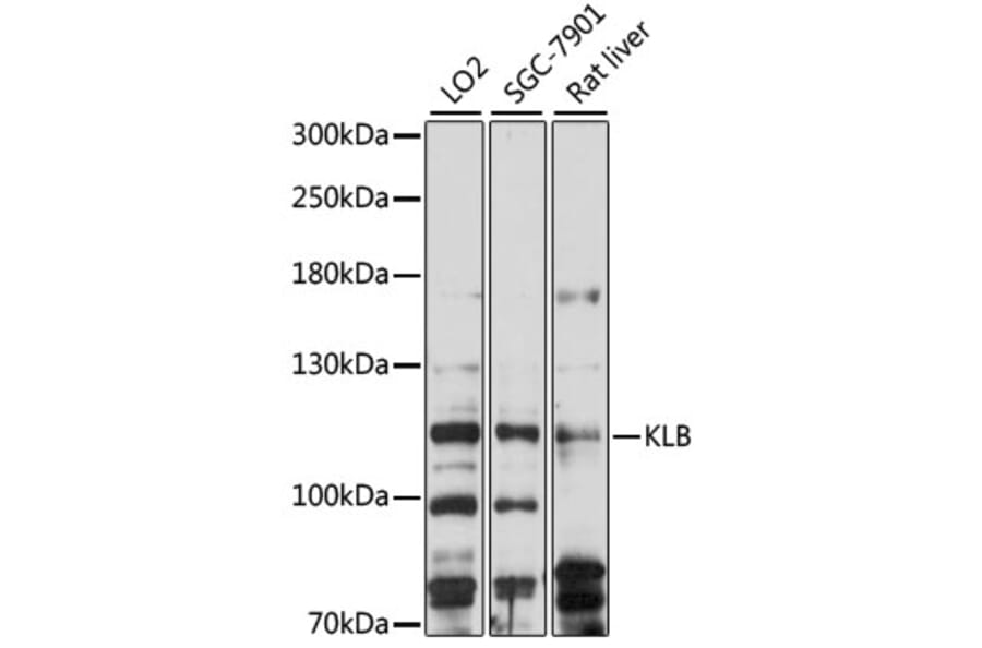 Western Blot - Anti-KLB Antibody (A88051) - Antibodies.com