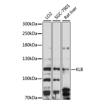 Western Blot - Anti-KLB Antibody (A88051) - Antibodies.com