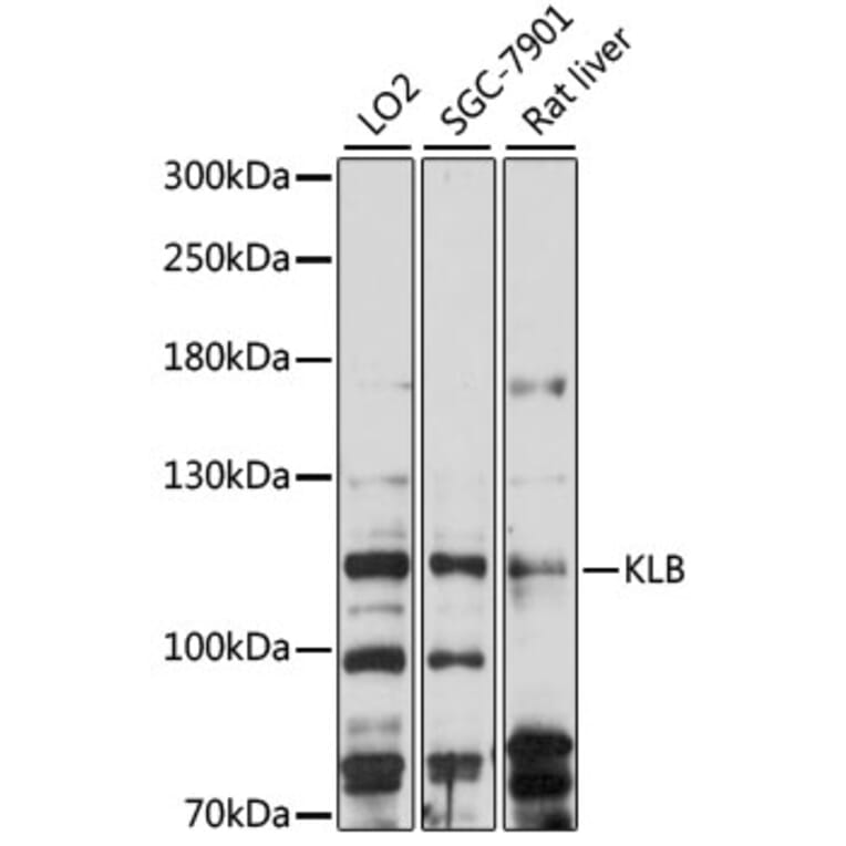 Western Blot - Anti-KLB Antibody (A88051) - Antibodies.com