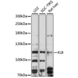 Western Blot - Anti-KLB Antibody (A88051) - Antibodies.com