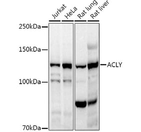 Western Blot - Anti-ATP citrate lyase Antibody (A88052) - Antibodies.com