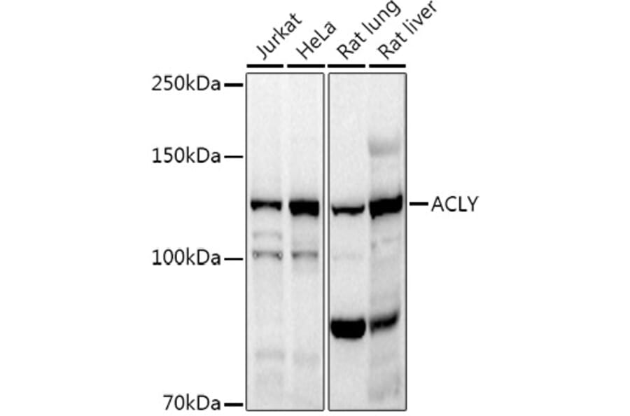 Western Blot - Anti-ATP citrate lyase Antibody (A88052) - Antibodies.com