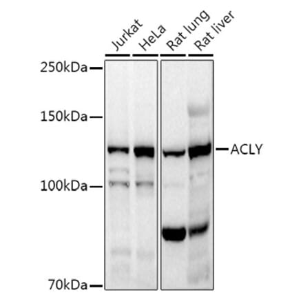 Western Blot - Anti-ATP citrate lyase Antibody (A88052) - Antibodies.com