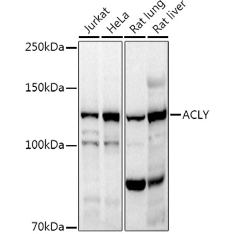 Western Blot - Anti-ATP citrate lyase Antibody (A88052) - Antibodies.com