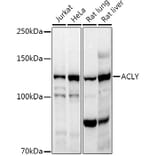 Western Blot - Anti-ATP citrate lyase Antibody (A88052) - Antibodies.com