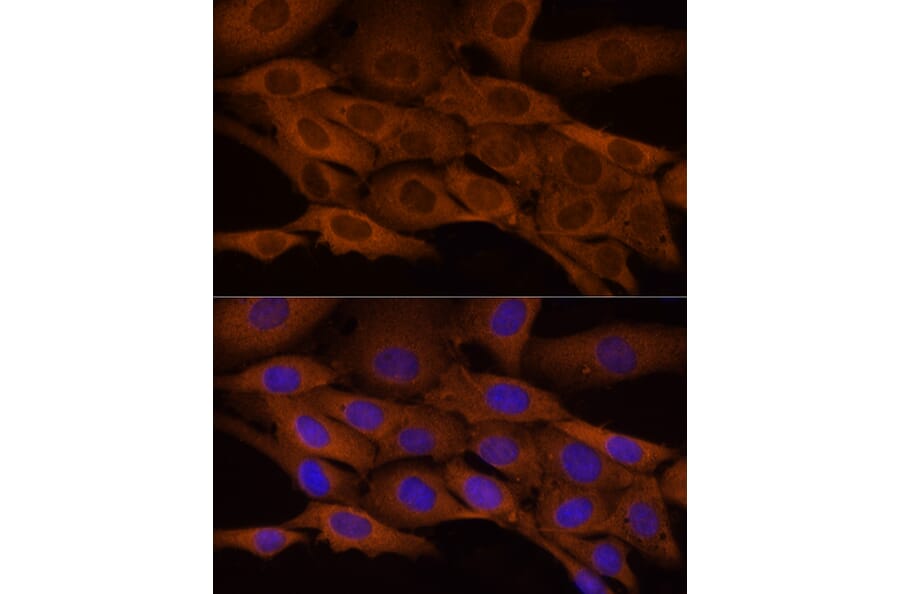 Immunofluorescence - Anti-ATP citrate lyase Antibody (A88052) - Antibodies.com