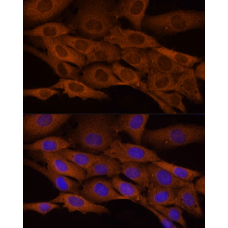 Immunofluorescence - Anti-ATP citrate lyase Antibody (A88052) - Antibodies.com