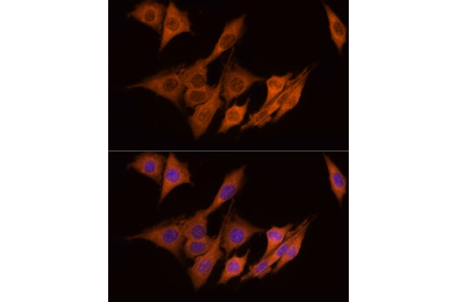 Immunofluorescence - Anti-ATP citrate lyase Antibody (A88052) - Antibodies.com