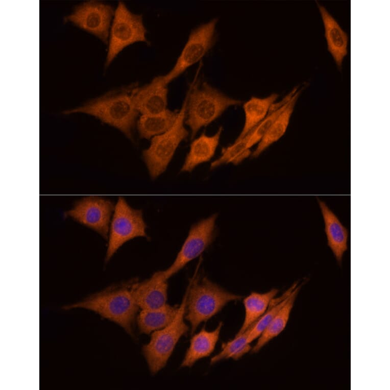 Immunofluorescence - Anti-ATP citrate lyase Antibody (A88052) - Antibodies.com