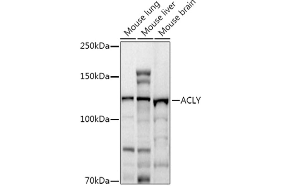 Western Blot - Anti-ATP citrate lyase Antibody (A88052) - Antibodies.com