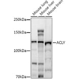 Western Blot - Anti-ATP citrate lyase Antibody (A88052) - Antibodies.com